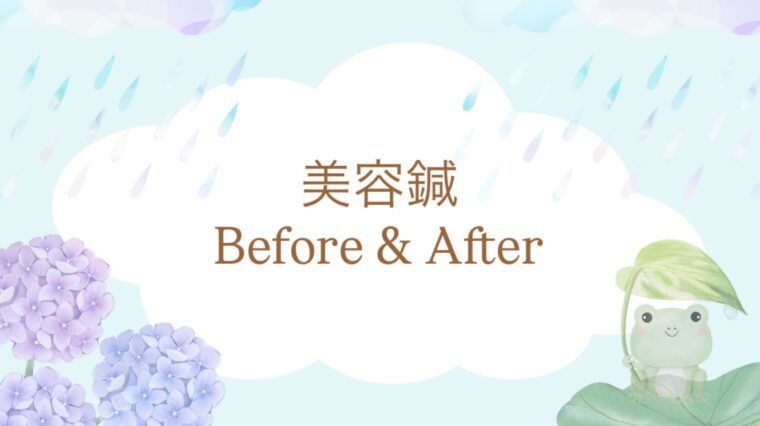 美容鍼 Before & After