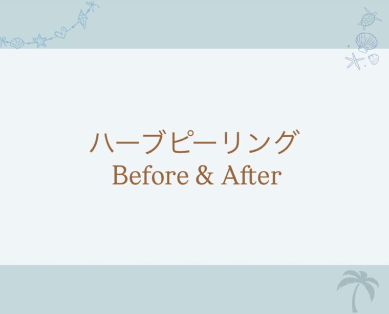ハーブピーリング Before & After